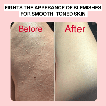 K-Vitality Cream™ 3 Month Supply