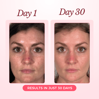Luxury Collagen Glow Up Mask 2.0 (Spa-Level Results)