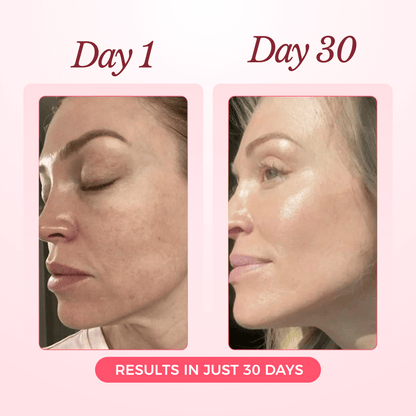 Collagen Glow Up Mask 2.0 - 90 Day Supply (8 Masks + 4 FREE!)