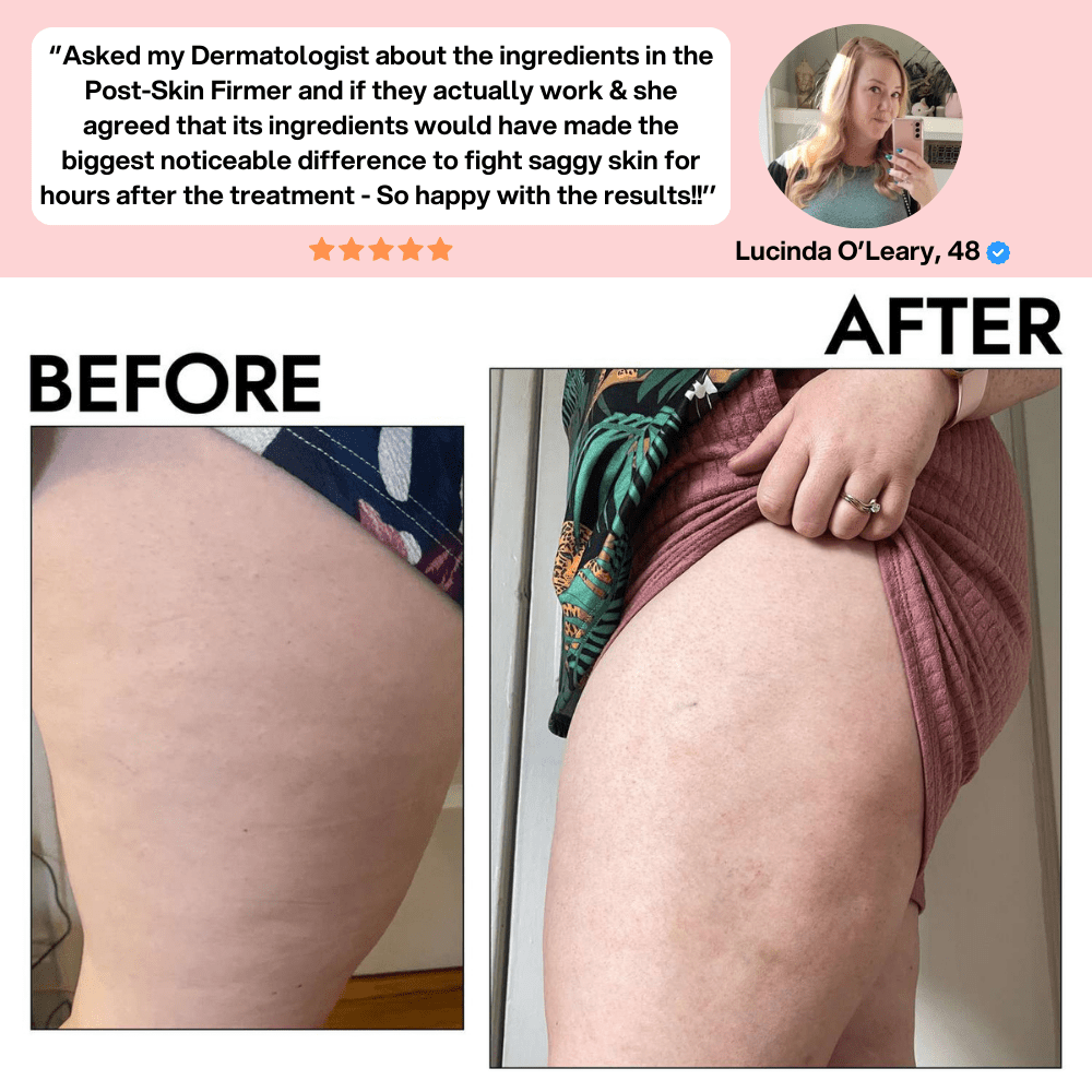 SheVitality™ Post-Skin Firmer