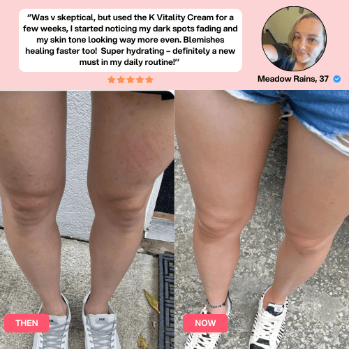 SheVitality™  Cellulite Relief Kit